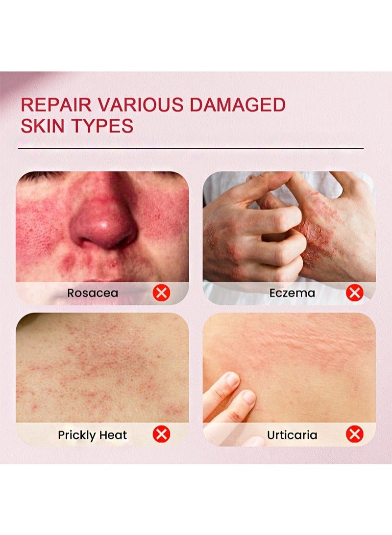 سوميفون 2 قطعة من الكالامين مرهم الوردية، تخفيف حكة الجلد واحمرار، تحسين حب الشباب - Image 4